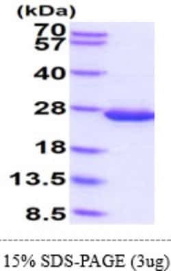 Novus Biologicals&trade;&nbsp;Recombinant E. coli Disulfide isomerase II Protein